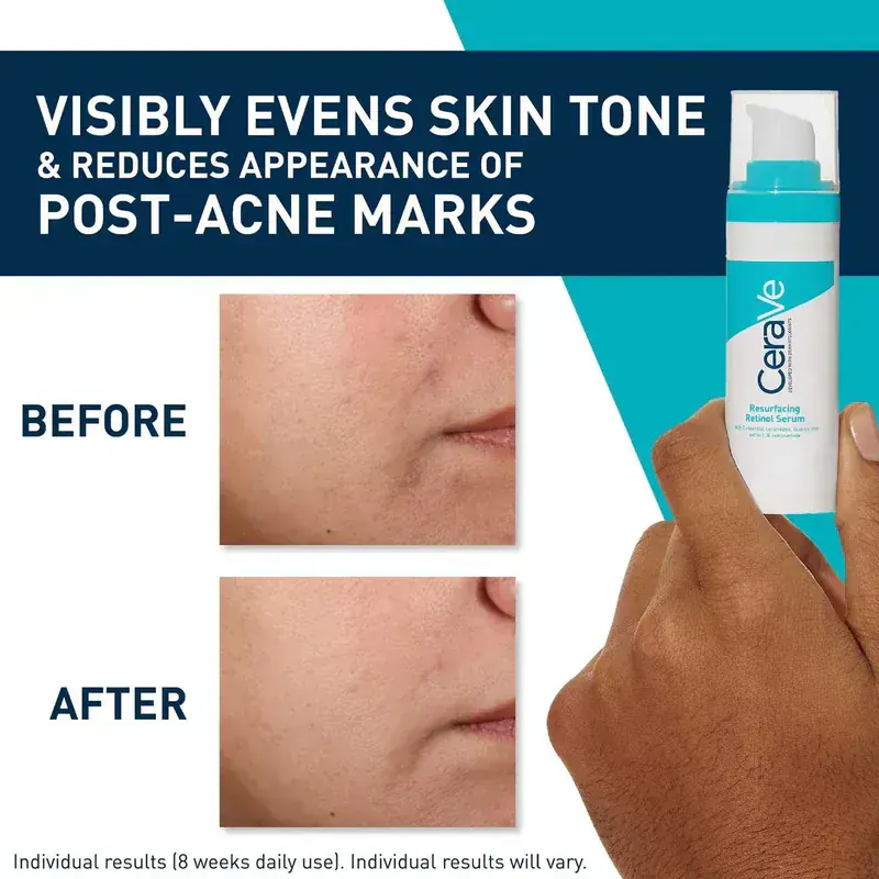 CeraVe Resurfacing Retinol Serum (AHA+BHA)